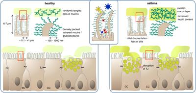 More Than Just a Barrier: The Immune Functions of the Airway Epithelium in Asthma Pathogenesis